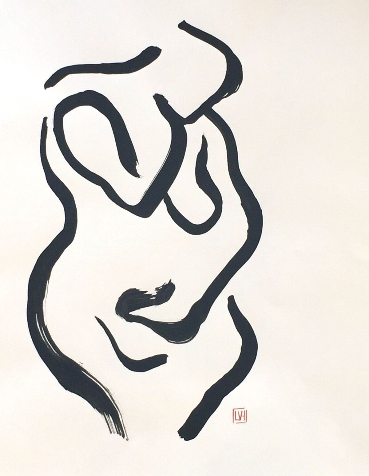Figure V